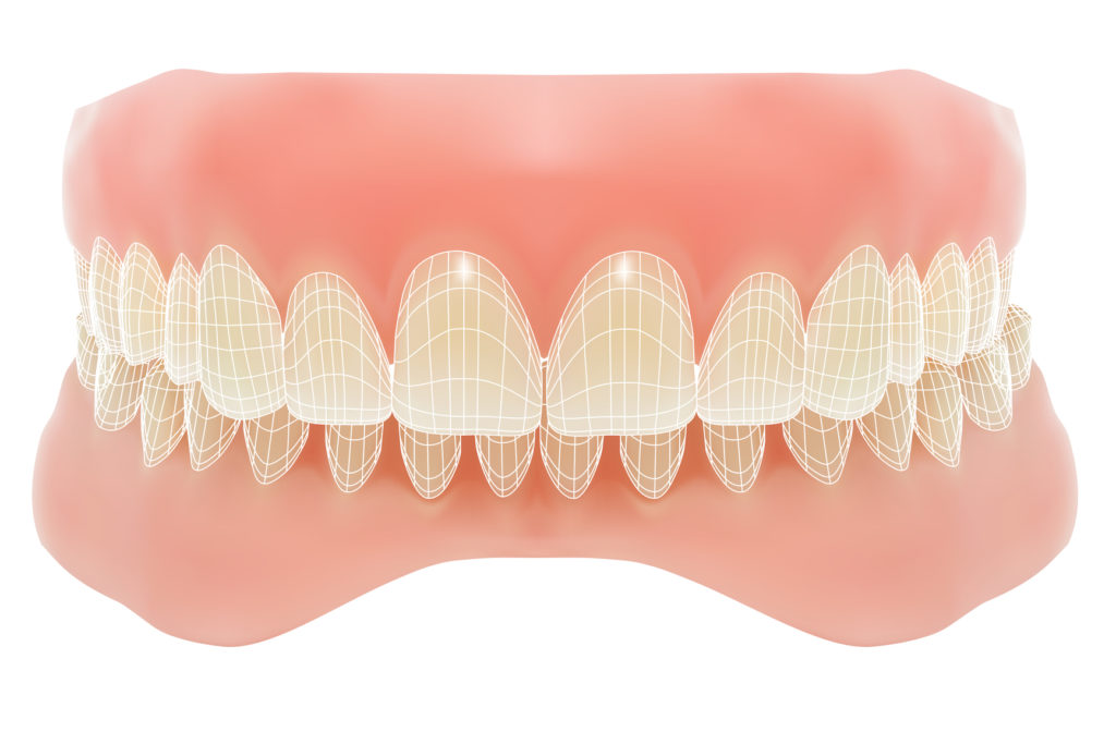 dentists cary nc: periodontal treatment