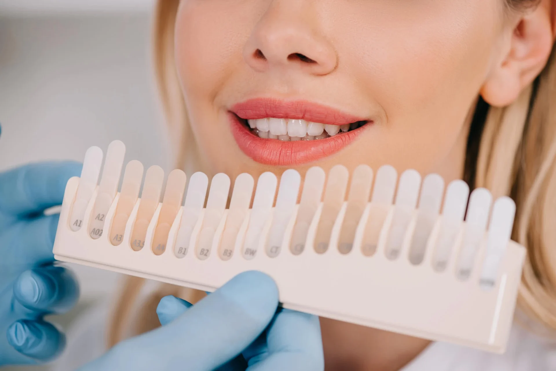 Extend Your Teeth Whitening in Cary NC Results