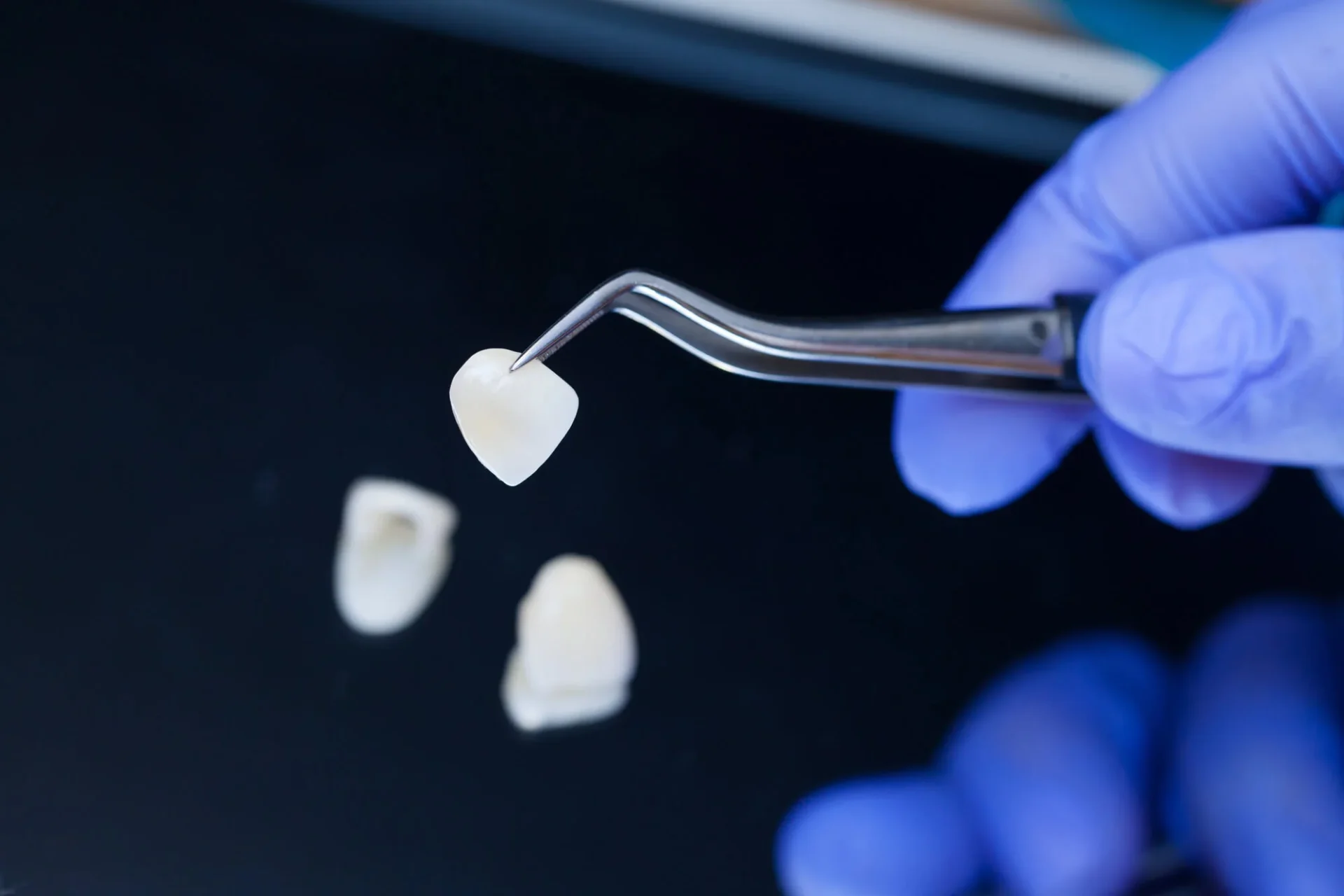 Dental Veneers in Cary NC
