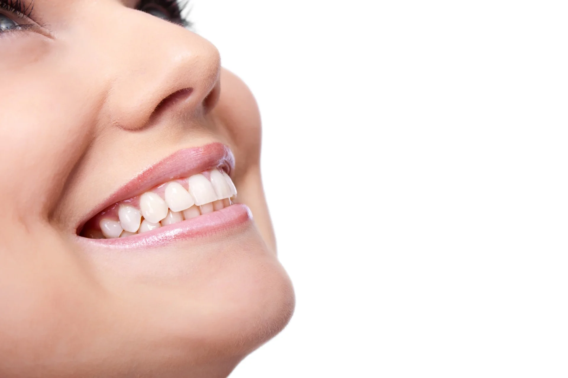 teeth whitening apex nc bright white smile results