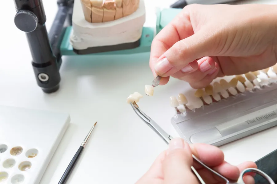 dental-veneers-cary-nc-veneer-placement