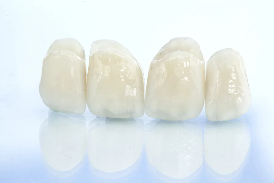 dental-crowns-cary-nc-closeup-of-four-natural-looking-porcelain-crowns